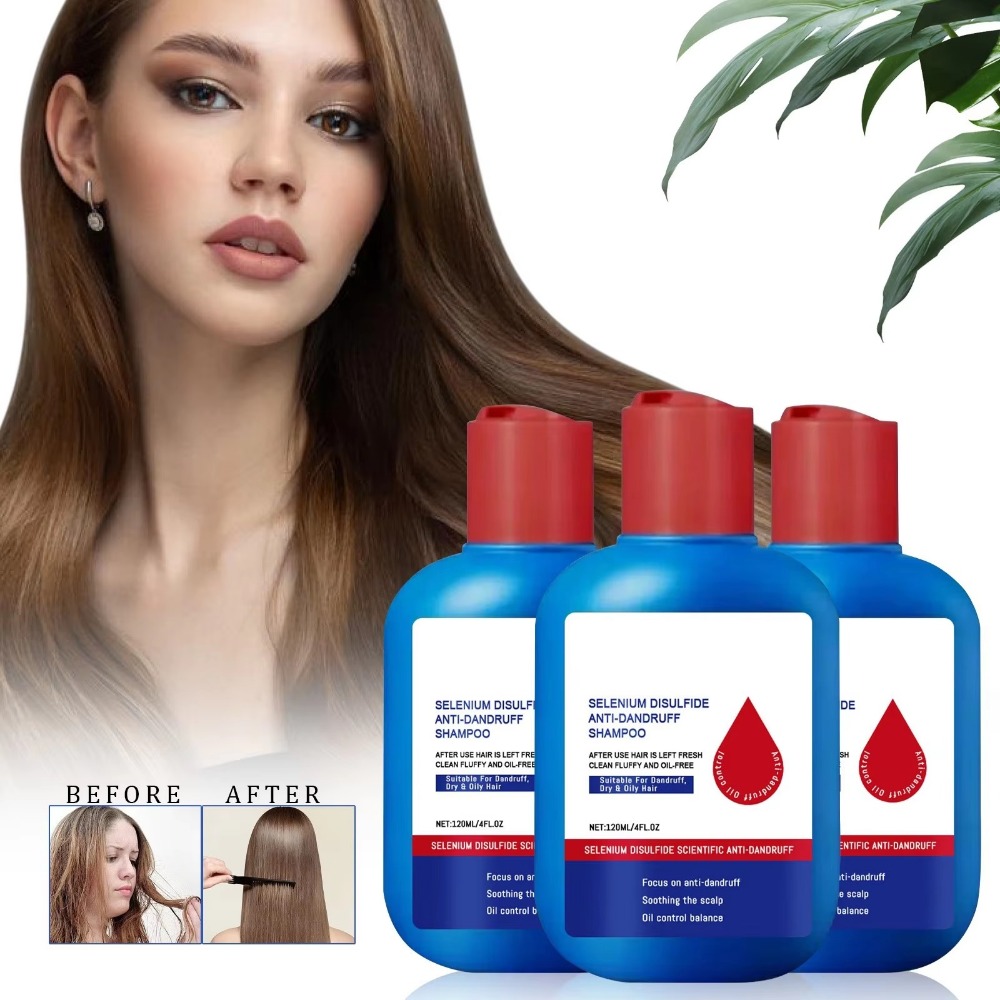 Hair Care Dandruff - Yeni 120ml Nipori Şampuan Yağ Kontrolü