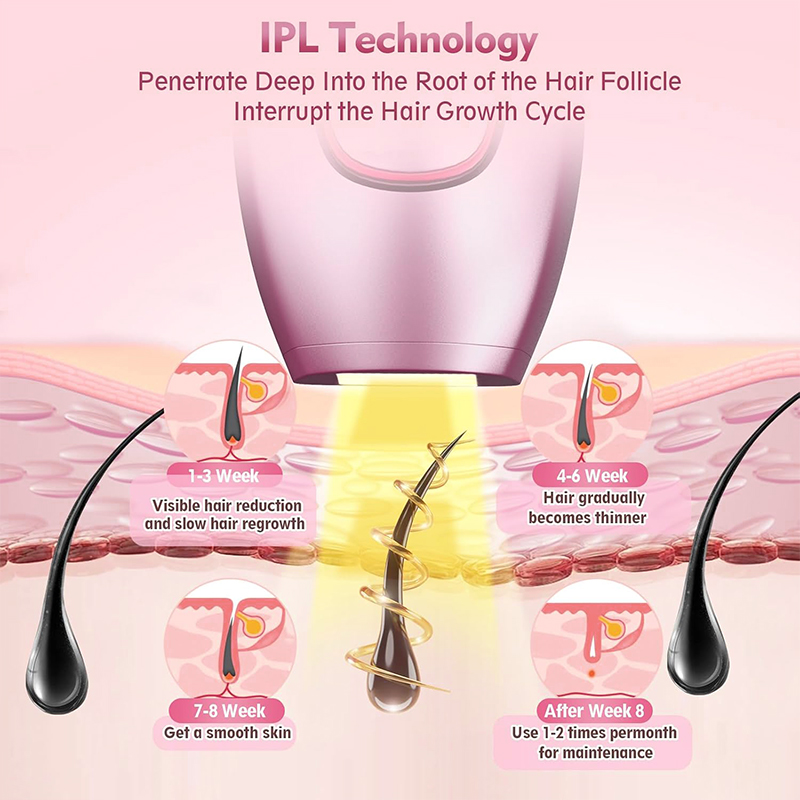 IPL lazer Saç Çıkarıcı Saç Kes - Hair Care Or Haircare incelemesi ve fiyatı
