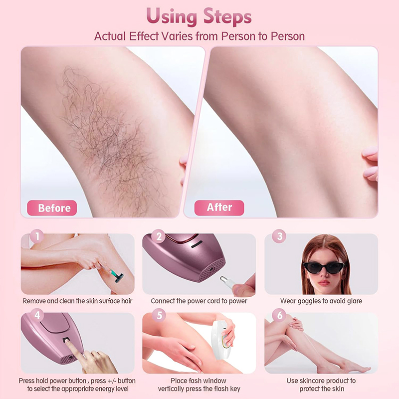 IPL lazer Saç Çıkarıcı Saç Kes - Hair Care Or Haircare incelemesi ve fiyatı