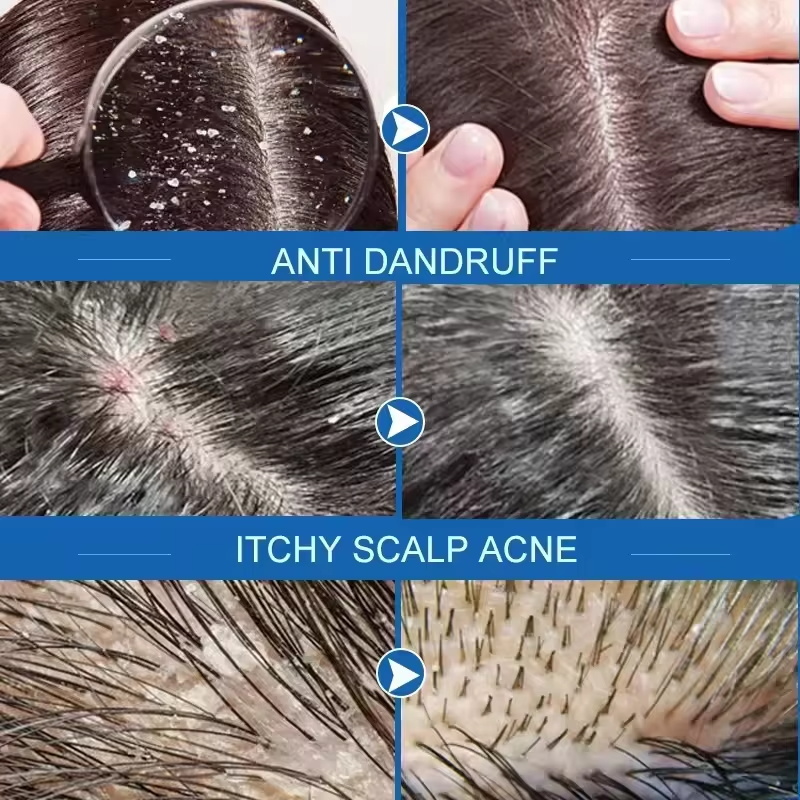 Hızlı Kepek Önleyici Saç Bakım - Hair Care Dandruff incelemesi ve fiyatı