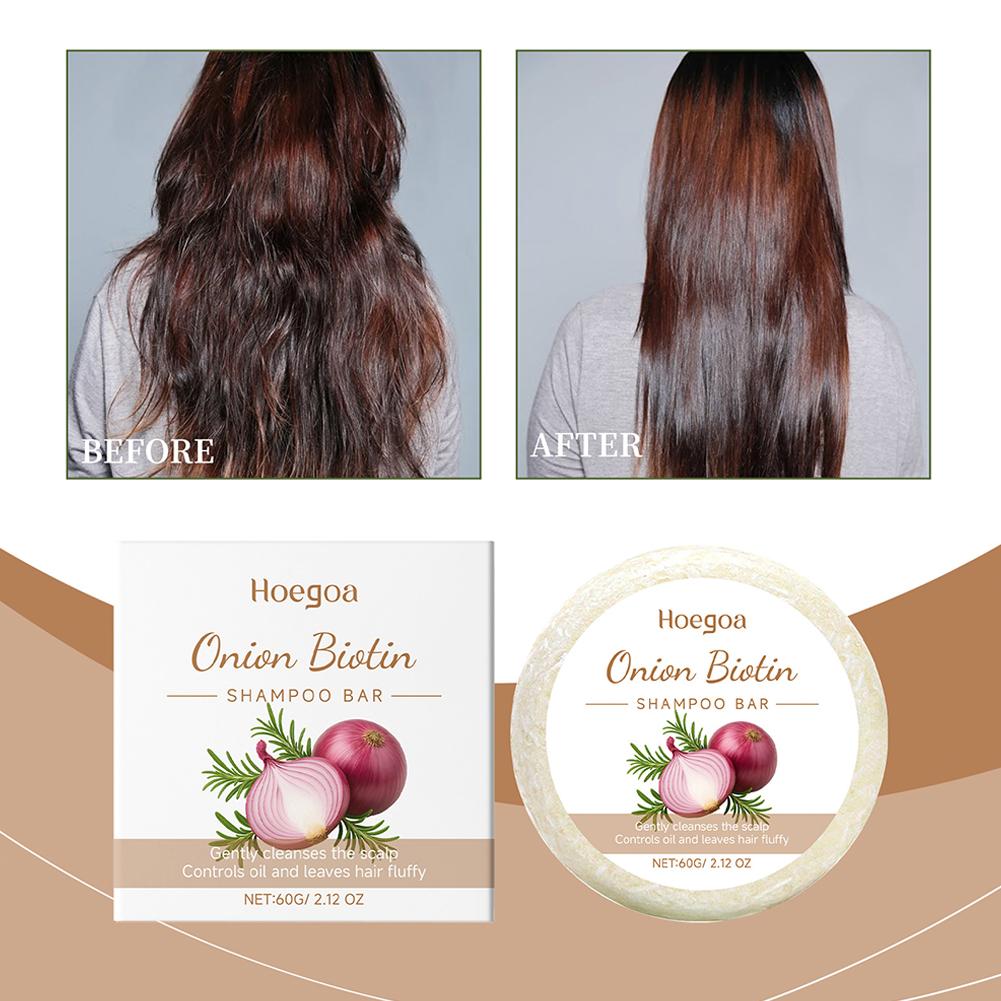 Soğan ve Hurma Özlü Şampuan Ka - Hair Care Dandruff incelemesi ve fiyatı