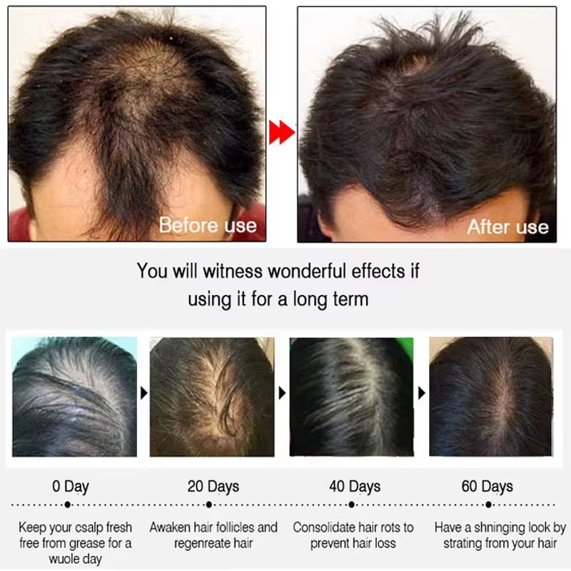 Hızlı Zencefilli Saç Uzatma Sp - Hair Care For Men incelemesi ve fiyatı