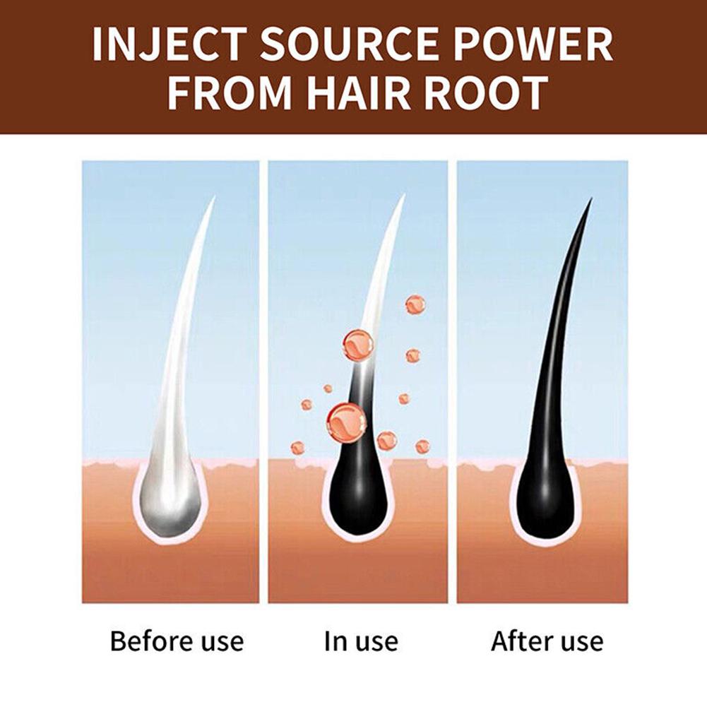 Doğal Polygonum El Yapımı Sabu - Hair Care Dandruff incelemesi ve fiyatı